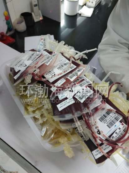 ��ɽ����ҽԺ���ڼ��ڳɹ�����һ�����ⲡ�ˡ�